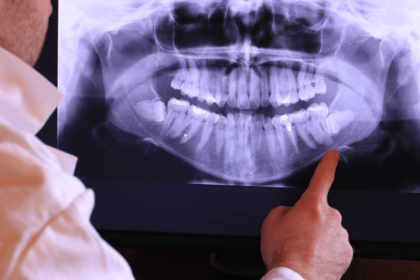 Best Emergency Dental Extractions in Merlin, OR
